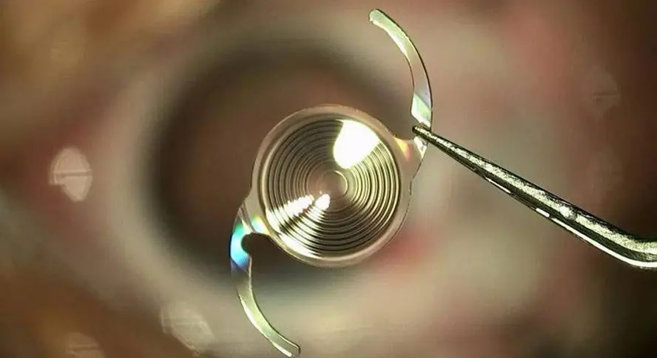 91视频下载污处理在人工晶状体肝素涂层过程中的应用